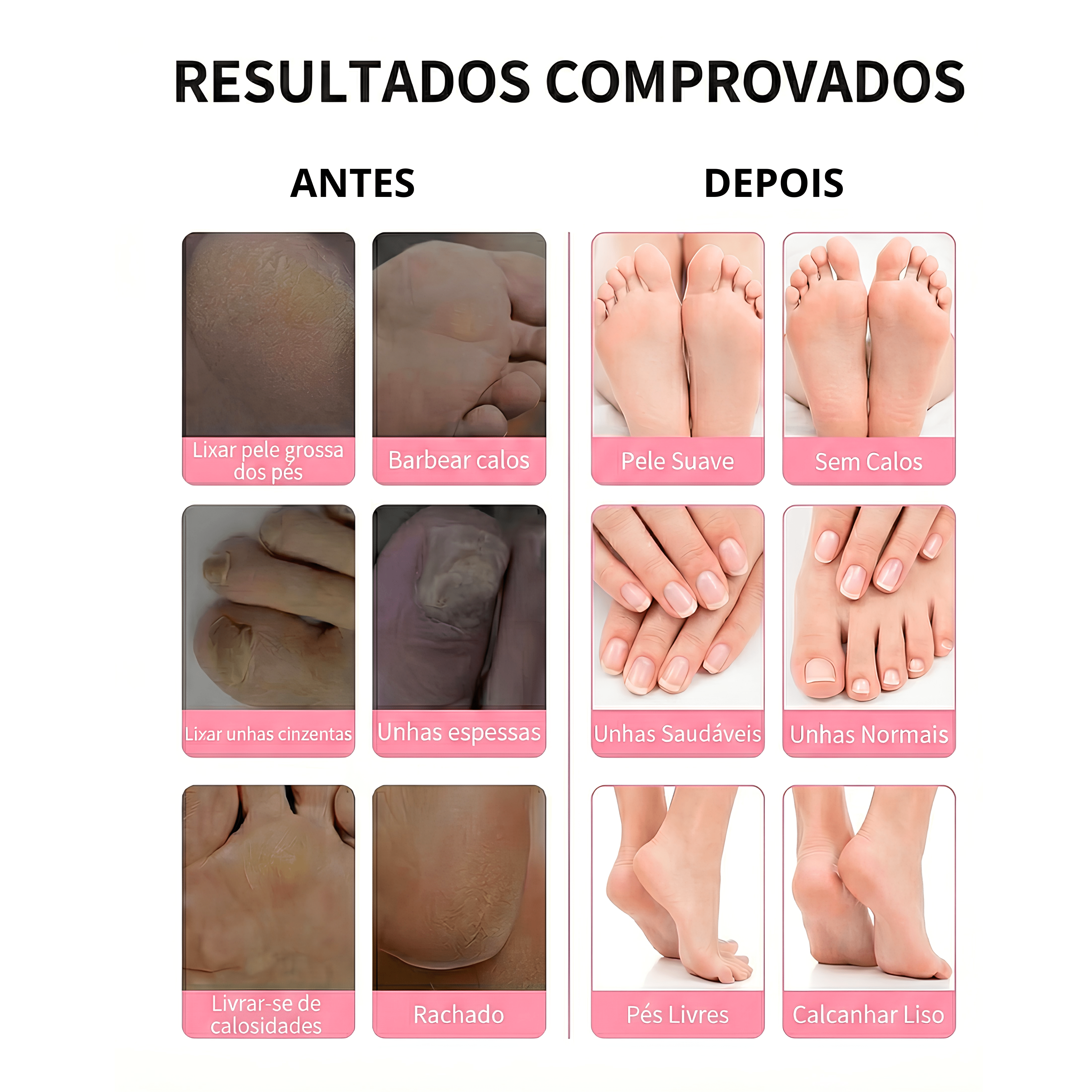 Removedor de Calos Elétrico